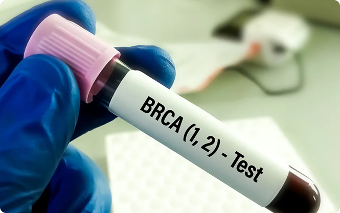 BRCA (1, 2) - Test